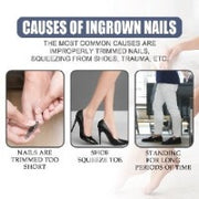 Ingrown Toe Nail Removing Treatment Oil - 