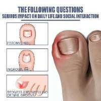 Ingrown Toe Nail Removing Treatment Oil - 