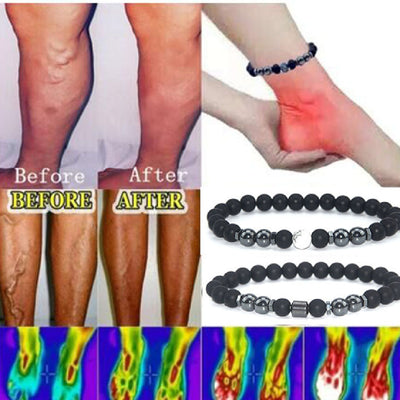 Frosted Black Beads Magnet Anklet European And American Retro Magnetic Foot Accessories SwagDials